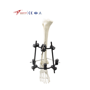 Unilateral Tibia & Femur External Fixator